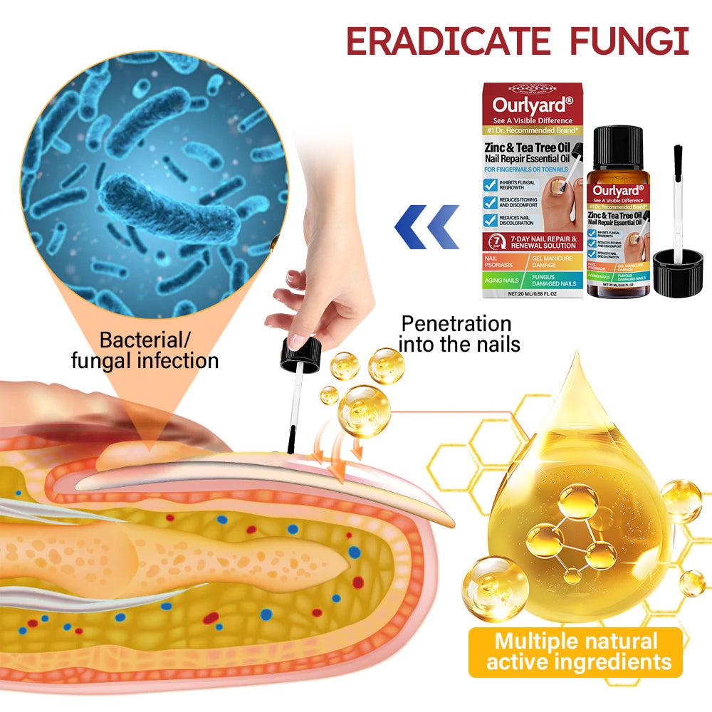 ✅ Made and Shipped from USA | Ourlyard® Zinc & Tea Tree Oil Nail Repair Essential Oil (Comprehensive repair, powerful treatment for all nail disorders) 🍀🍀