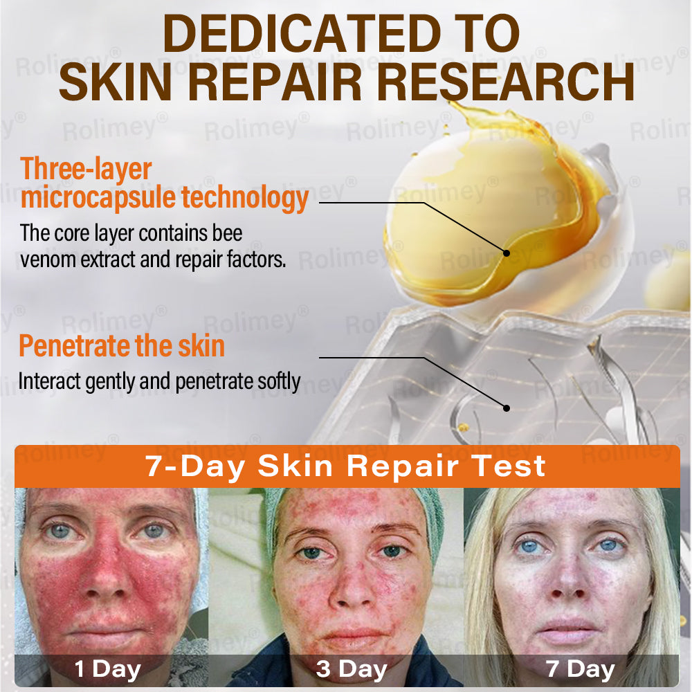 ✅Official Store | ✨ Rolimey® Bee Venom Golden Liposome Capsule Repair Cream 🧑🏼⚕️(For skin prone to tinea, psoriasis, warts, hidradenitis, and varicose concerns)