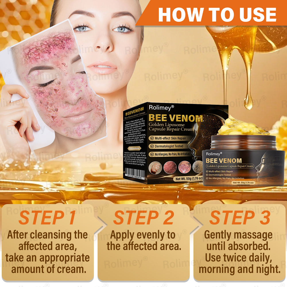 ✅Official Store | ✨ Rolimey® Bee Venom Golden Liposome Capsule Repair Cream 🧑🏼⚕️(For skin prone to tinea, psoriasis, warts, hidradenitis, and varicose concerns)