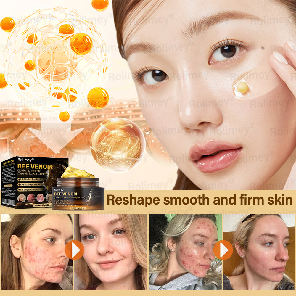 ✅Official Store | ✨ Rolimey® Bee Venom Golden Liposome Capsule Repair Cream 🧑🏼⚕️(For skin prone to tinea, psoriasis, warts, hidradenitis, and varicose concerns)