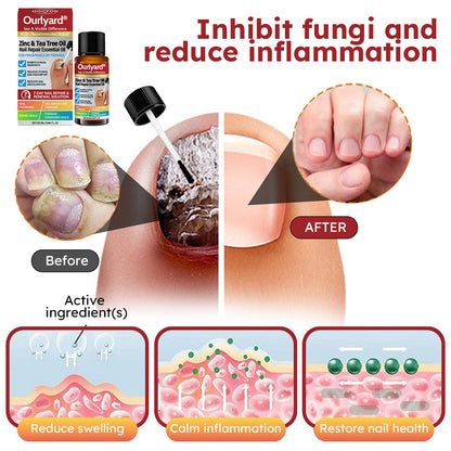 ✅ Made and Shipped from USA | Ourlyard® Zinc & Tea Tree Oil Nail Repair Essential Oil (Comprehensive repair, powerful treatment for all nail disorders) 🍀🍀
